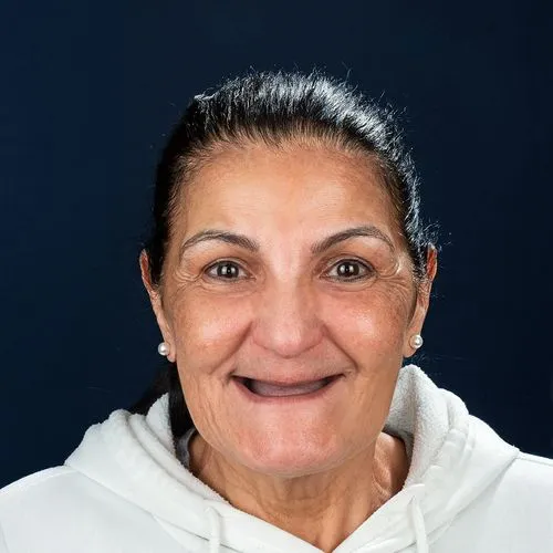 Before — Dental Implants