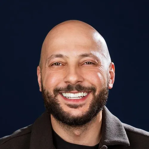 After — Full Mouth Implants