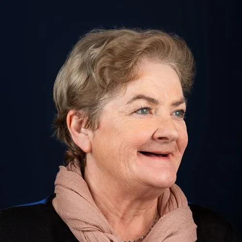 Before — Dental Implants