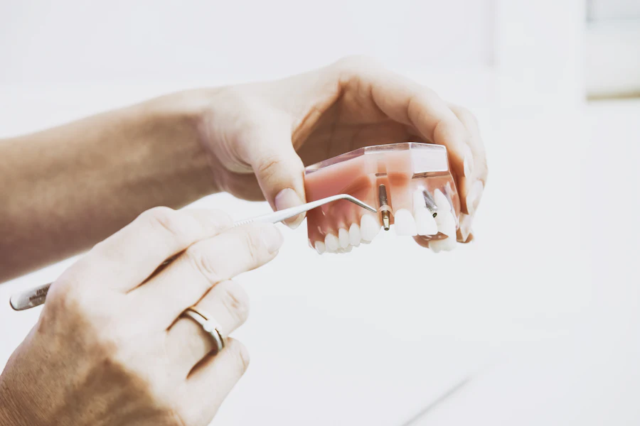 Porcelain veneers